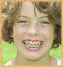 stock photo of girl with braces